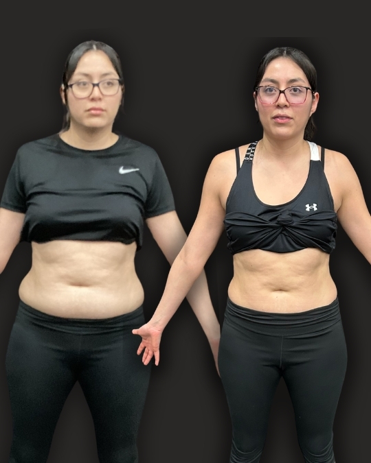 Marlen before and after