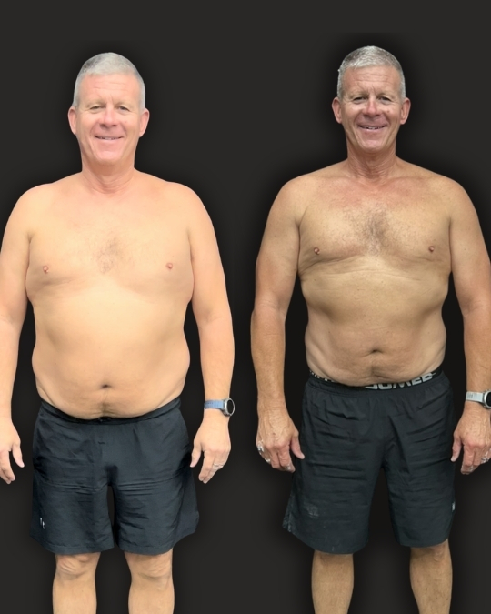Paul before and after